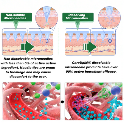 𝐂𝐚𝐫𝐞𝐔𝐩𝐥𝐢𝐟𝐭® has a surprise upgrade just for you! You've already got an amazing offer — but now you've unlocked an even better one:👉 You'll get a massive 30% off your next purchase — for the next five minutes only!